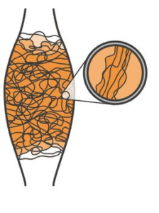 Verstoord bindweefsel